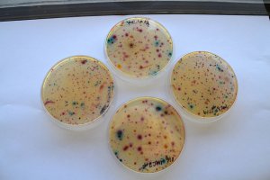 E. coli samples