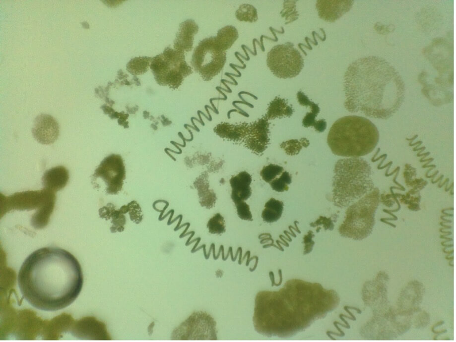 Microscopic image - cyanobacteria and green algae